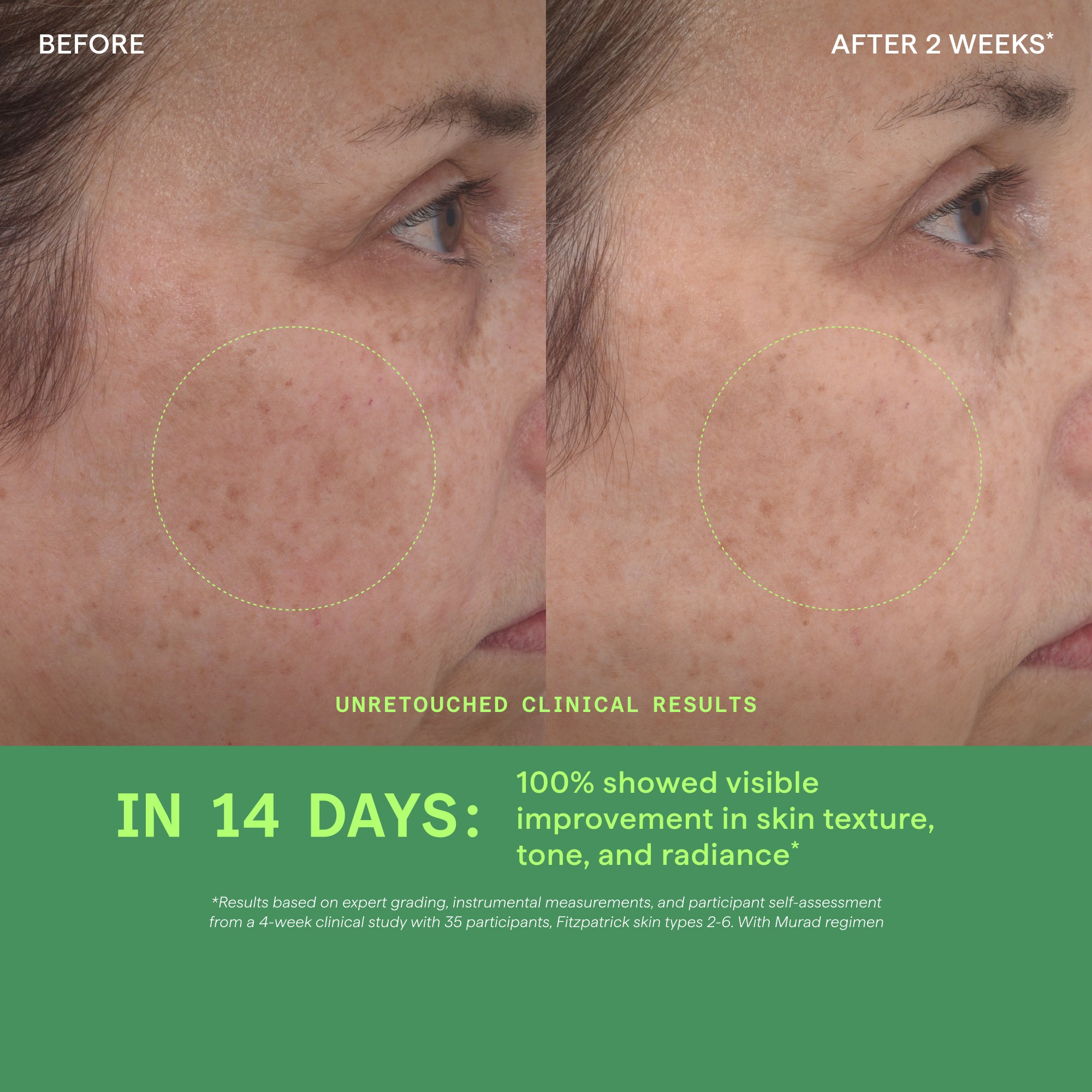 Retinol Renewal Limited Edition Set - Image 5