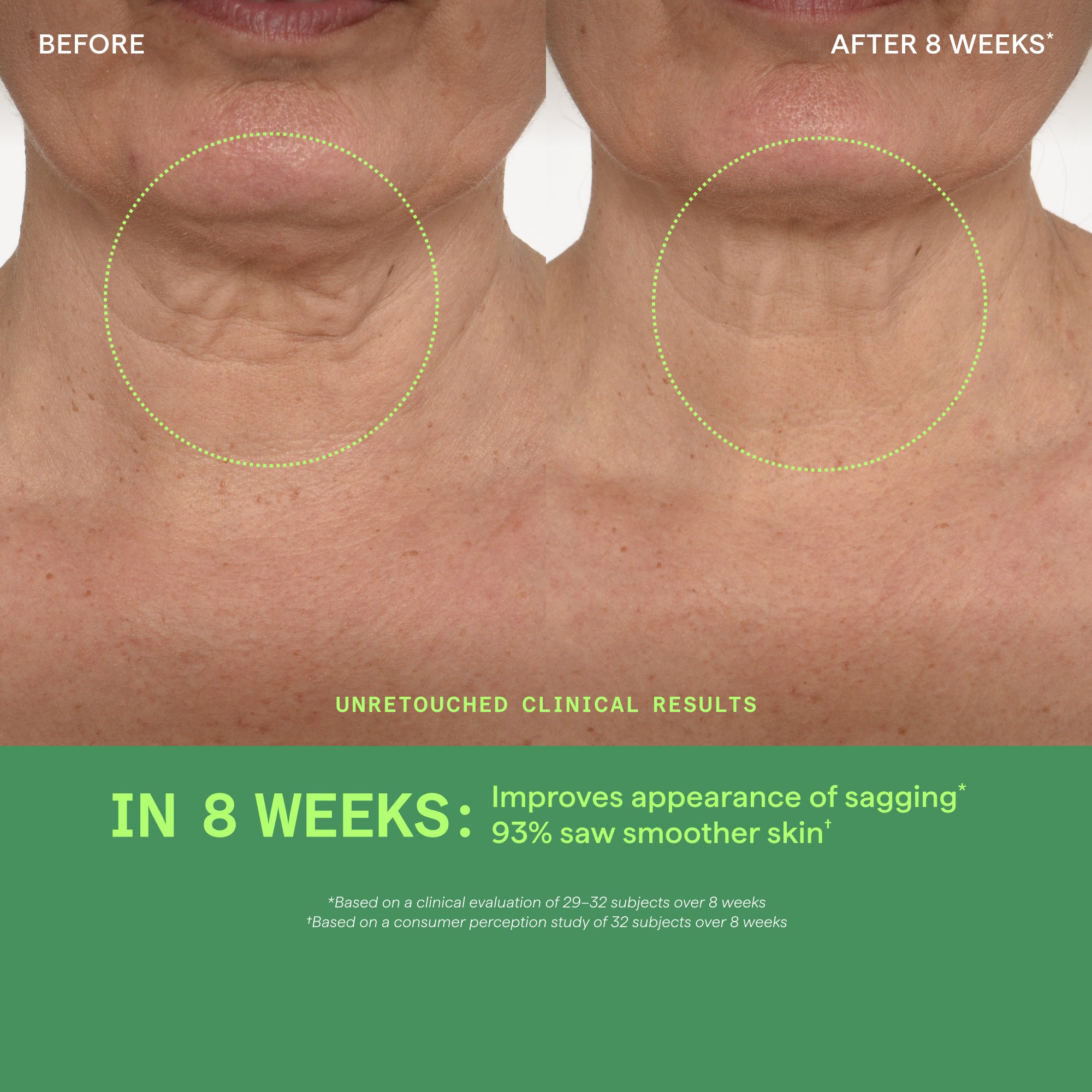 Retinal ReSculpt Neck & D??collet?? Lifting Serum - Image 3